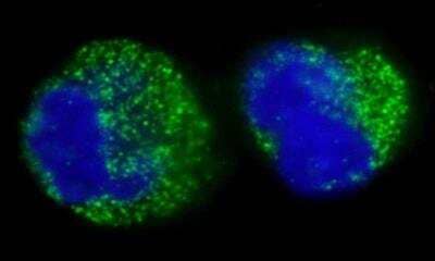 Immunocytochemistry/Immunofluorescence: BCR Antibody [NBP1-19097] - Human K562 cells (contains the chromosomal translocation, t(9:22) that creates the BCR/ABL fusion gene).  Antibody used at a dilution of 1:1,000 (1ug/ml). Detection: Green-fluorescent goat anti-rabbit IgG - AlexaFluor 488 used at a dilution of 1:1,000.