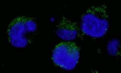 <b>Independent Antibodies Validation and Biological Strategies Validation.</b>Immunocytochemistry/Immunofluorescence: BCR Antibody [NBP1-19098] - Human K562 cells (contains the chromosomal translocation, t(9:22) that creates the BCR/ABL fusion gene).  Antibody used at a dilution of 1:1,000 (1ug/ml). Detection: Green-fluorescent goat anti-rabbit IgG - Alexa Fluor 488 used at a dilution of 1:1,000.