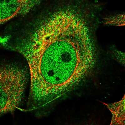 Immunocytochemistry/Immunofluorescence: BCR Antibody [NBP1-89137] - Immunofluorescent staining of human cell line U-2 OS shows localization to nucleoplasm & cytosol.