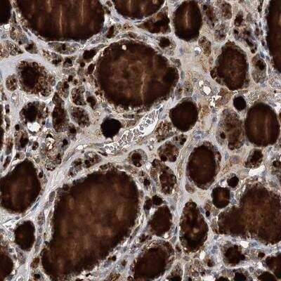 Immunohistochemistry-Paraffin: BCR Antibody [NBP1-89137] - Staining of human thyroid gland shows strong cytoplasmic and extra cellular positivity in glandular cells.