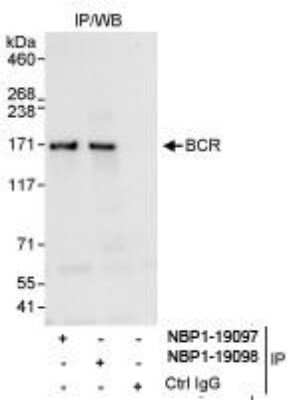 Immunoprecipitation: BCR Antibody [NBP1-19097] - Whole cell lysate (1 mg for IP, 20% of IP loaded) from HeLa cells.  Affinity purified rabbit anti-BCR antibody  used for IP at 10 mcg/mg lysate. BCR was also immunoprecipitated by rabbit anti-BCR antibody NBP1-19098, which recognizes a downstream epitope