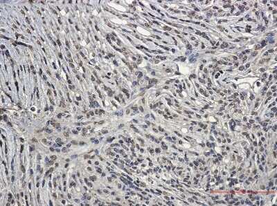 Immunohistochemistry-Paraffin: BCR Antibody (S02-6I0) [NBP3-15006] - Immunohistochemistry of BCR in paraffin-embedded Human Brain using BCR Rabbit mAb at dilution 1/50