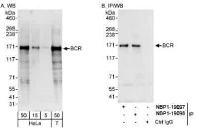 Western Blot: BCR Antibody [NBP1-19098] - Whole cell lysate from HeLa and 293T cells. BCR was also immunoprecipitated by rabbit anti-BCR antibody NBP1-19097.