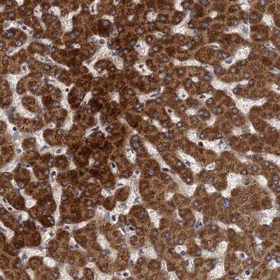 Immunohistochemistry-Paraffin: BCS1L Antibody [NBP1-88677] - Staining of human liver shows strong cytoplasmic positivity in hepatocytes.