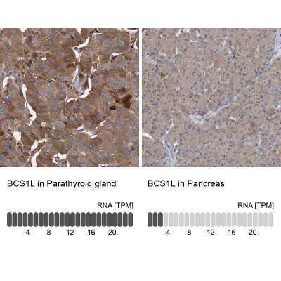 <b>Orthogonal Strategies Validation. </b>Immunohistochemistry-Paraffin: BCS1L Antibody [NBP1-88678] - Staining in human parathyroid gland and pancreas tissues using anti-BCS1L antibody. Corresponding BCS1L RNA-seq data are presented for the same tissues.