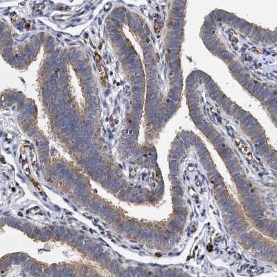 Immunohistochemistry-Paraffin: BCS1L Antibody [NBP1-88678] - Staining of human Fallopian tube shows moderate positivity in cytoplasm in glandular cells.