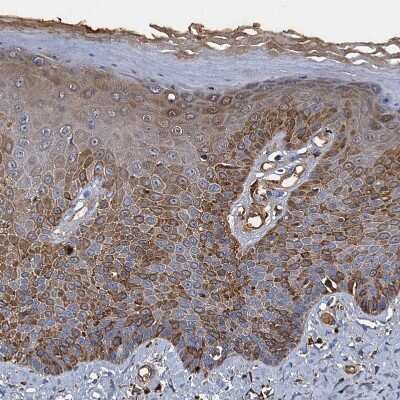 Immunohistochemistry-Paraffin: BCS1L Antibody [NBP1-88678] - Staining of human skin shows moderate positivity in cytoplasm in squamous epithelial cells.