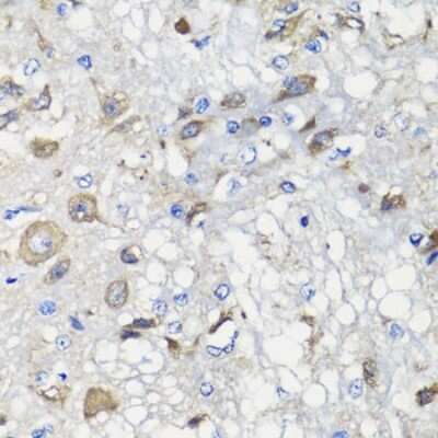 Immunohistochemistry-Paraffin: BCS1L Antibody [NBP2-92916] - Paraffin-embedded rat brain using BCS1L .