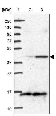 Western Blot: BCS1L Antibody [NBP1-88677] - Lane 1: Marker  [kDa] 250, 130, 95, 72, 55, 36, 28, 17, 10.  Lane 2: Human cell line RT-4.  Lane 3: Human cell line U-251MG sp