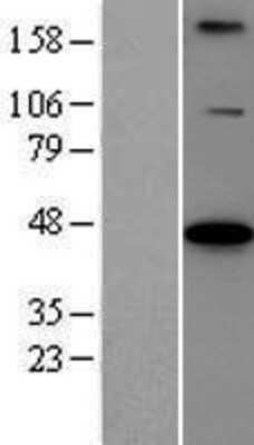 Western Blot: BCS1L Overexpression Lysate (Adult Normal) [NBP2-07879] Left-Empty vector transfected control cell lysate (HEK293 cell lysate); Right -Over-expression Lysate for BCS1L.