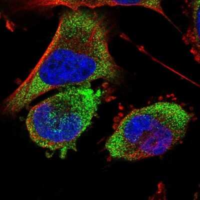 Immunocytochemistry/Immunofluorescence: BDH2 Antibody [NBP2-32713] - Staining of human cell line U-251 MG shows localization to cytosol. Antibody staining is shown in green.