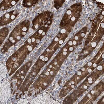 Immunohistochemistry-Paraffin: BDH2 Antibody [NBP1-85218] - Staining of human duodenum shows strong cytoplasmic and nuclear positivity in glandular cells.