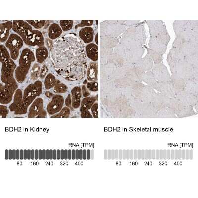 <b>Orthogonal Strategies Validation. </b>Immunohistochemistry-Paraffin: BDH2 Antibody [NBP1-85218] - Staining in human kidney and skeletal muscle tissues using anti-BDH2 antibody. Corresponding BDH2 RNA-seq data are presented for the same tissues.