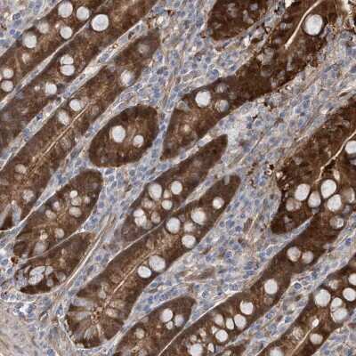 Immunohistochemistry-Paraffin: BDH2 Antibody [NBP1-85218] - Staining of human duodenum shows moderate to strong cytoplasmic positivity in glandular cells.