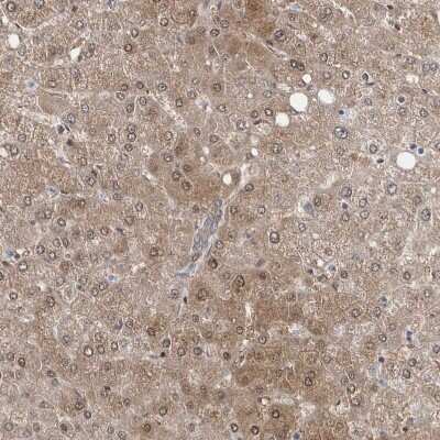 Immunohistochemistry-Paraffin: BDH2 Antibody [NBP1-85218] - Staining of human liver shows moderate cytoplasmic positivity in hepatocytes.