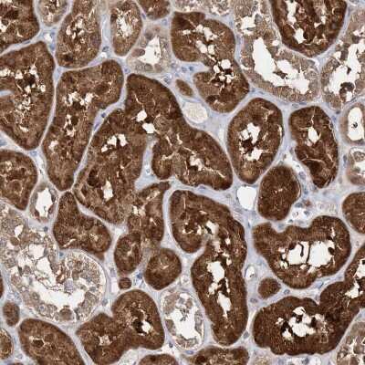 Immunohistochemistry-Paraffin: BDH2 Antibody [NBP2-32713] - Staining of human kidney shows strong cytoplasmic positivity in cells in tubules.