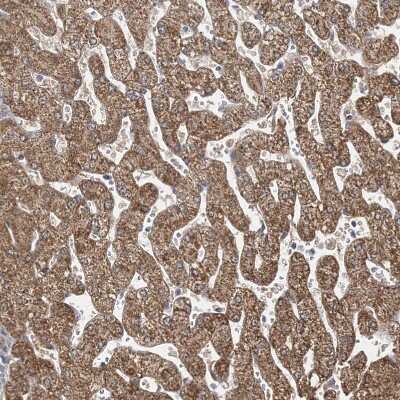 Immunohistochemistry-Paraffin: BDH2 Antibody [NBP2-32713] - Staining of human liver shows strong granular cytoplasmic positivity in hepatocytes.