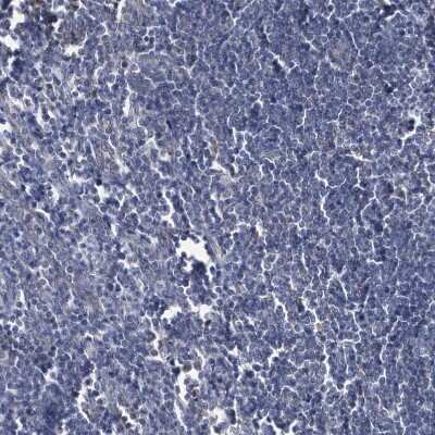 Immunohistochemistry-Paraffin: BDH2 Antibody [NBP2-32713] - Staining of human lymph node shows no positivity in non-germinal center cells as expected.