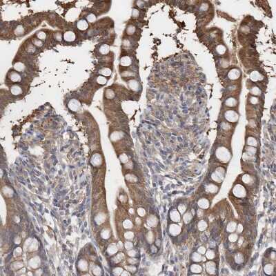 Immunohistochemistry-Paraffin: BDH2 Antibody [NBP2-32713] - Staining of human small intestine shows moderate cytoplasmic positivity in glandular cells.