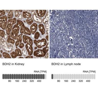 Immunohistochemistry-Paraffin: BDH2 Antibody [NBP2-32713] - Analysis in human kidney and lymph node tissues using NBP2-32713 antibody. Corresponding BDH2 RNA-seq data are presented for the same tissues.