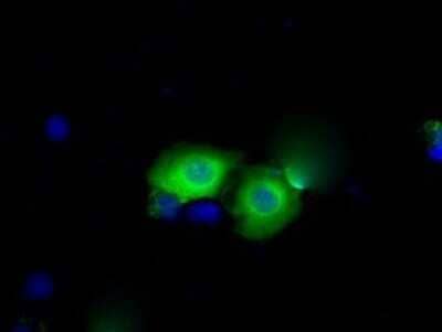 Immunocytochemistry/Immunofluorescence: BDH2 Antibody (OTI2G1) - Azide and BSA Free [NBP2-72067] - Staining of COS7 cells transiently transfected by pCMV6-ENTRY BDH2.