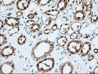 Immunohistochemistry: BDH2 Antibody (OTI2G1) - Azide and BSA Free [NBP2-72067] - Staining of paraffin-embedded Human Kidney tissue using anti-BDH2 mouse monoclonal antibody.