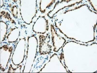 Immunohistochemistry: BDH2 Antibody (OTI2G1) - Azide and BSA Free [NBP2-72067] - Staining of paraffin-embedded Human thyroid tissue using anti-BDH2 mouse monoclonal antibody.