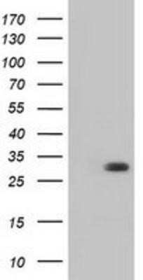 Western Blot: BDH2 Antibody (OTI2G1) - Azide and BSA Free [NBP2-72067] - HEK293T cells were transfected with the pCMV6-ENTRY control (Left lane) or pCMV6-ENTRY BDH2 (Right lane) cDNA for 48 hrs and lysed. Equivalent amounts of cell lysates (5 ug per lane) were separated by SDS-PAGE and immunoblotted with anti-BDH2.