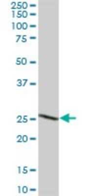 Western Blot: BDH2 Antibody [H00056898-B01P] - Analysis of DHRS6 expression in human kidney.