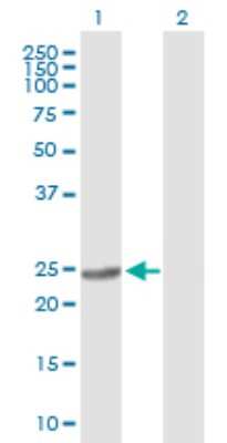 Western Blot: BDH2 Antibody [H00056898-B01P] - Analysis of BDH2 expression in transfected 293T cell line by BDH2 polyclonal antibody.  Lane 1: DHRS6 transfected lysate(26.95 KDa). Lane 2: Non-transfected lysate.