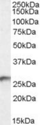 Western Blot: BDH2 Antibody [NB100-93379] - (0.3ug/ml) staining of Human Kidney lysate (35ug protein in RIPA buffer).