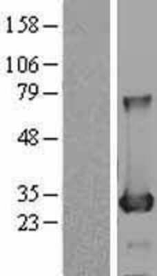 Western Blot: BDH2 Overexpression Lysate (Adult Normal) [NBL1-07958] Left-Empty vector transfected control cell lysate (HEK293 cell lysate); Right -Over-expression Lysate for BDH2.