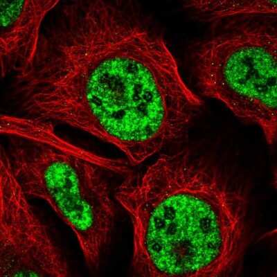 Immunocytochemistry/Immunofluorescence: BDNF Antibody [NBP2-55052] - Staining of human cell line U-2 OS shows localization to nuclear speckles. Antibody staining is shown in green.