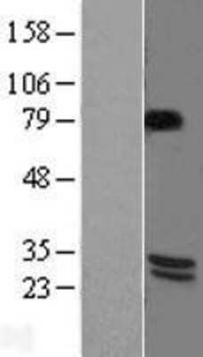 Western Blot: BDNF Overexpression Lysate (Adult Normal) [NBL1-07965] Left-Empty vector transfected control cell lysate (HEK293 cell lysate); Right -Over-expression Lysate for BDNF.