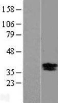 Western Blot: BDNF Overexpression Lysate (Adult Normal) [NBP2-05165] Left-Empty vector transfected control cell lysate (HEK293 cell lysate); Right -Over-expression Lysate for BDNF.
