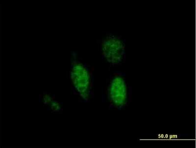 Immunocytochemistry/ Immunofluorescence BDP1 Antibody