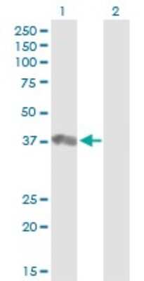 Western Blot BDP1 Antibody