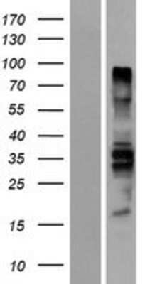 Western Blot BDP1 Overexpression Lysate