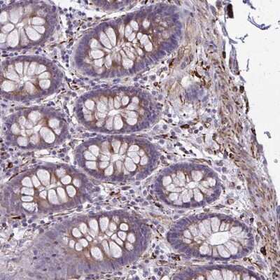 Immunohistochemistry: BEN Domain Containing 5 Antibody [NBP2-31701] - Staining of human colon shows moderate cytoplasmic positivity in glandular cells.