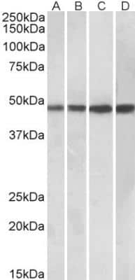 Western Blot BEN Domain Containing 5 Antibody