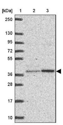 Western Blot: BEN Domain Containing 5 Antibody [NBP2-31576] - Lane 1: Marker  [kDa] 250, 130, 95, 72, 55, 36, 28, 17, 10.  Lane 2: Human cell line RT-4.  Lane 3: Human cell line U-251MG sp