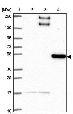 Western Blot BEN Domain Containing 5 Antibody - BSA Free