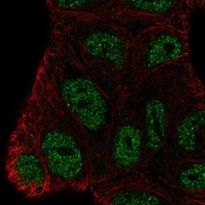 Immunocytochemistry/Immunofluorescence: BEND3 Antibody [NBP2-57160] - Staining of human cell line RT4 shows localization to nucleoplasm.