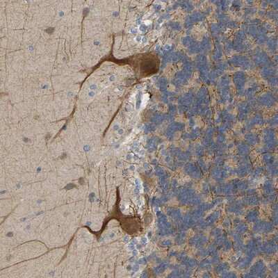 Immunohistochemistry-Paraffin BEND3 Antibody - BSA Free