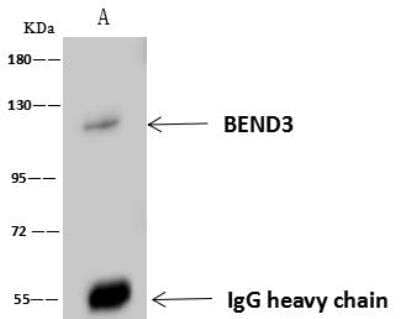 Immunoprecipitation: BEND3 Antibody [NBP3-12571] - Lane A:0.5 mg U-251 MG Whole Cell Lysate4 uL anti-BEND3 rabbit polyclonal antibody and 60 ug of Immunomagnetic beads Protein A/G.Primary antibody:Anti-BEND3 rabbit polyclonal antibody,at 1:100 dilution Secondary antibody:Goat Anti-Rabbit IgG (H+L)/HRP at 1/10000 dilutionDeveloped using the ECL technique.Performed under reducing conditions.Predicted band size: 94 kDaObserved band size :120 kDa