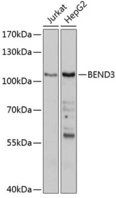 Western Blot: BEND3 Antibody [NBP3-04003] - Analysis of extracts of various cell lines, using BEND3 antibody at 1:1000 dilution. Secondary antibody: HRP Goat Anti-Rabbit IgG (H+L) at 1:10000 dilution. Lysates/proteins: 25ug per lane. Blocking buffer: 3% nonfat dry milk in TBST. Detection:  ECL Basic Kit