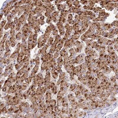 Immunohistochemistry-Paraffin: BEND7 Antibody [NBP1-89913] - Staining of human liver shows strong cytoplasmic positivity in hepatocytes.