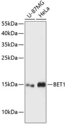 Western Blot: BET1 Antibody [NBP2-92710] - Analysis of extracts of various cell lines, using BET1 at 1:3000 dilution.Secondary antibody: HRP Goat Anti-Rabbit IgG (H+L) at 1:10000 dilution.Lysates/proteins: 25ug per lane.Blocking buffer: 3% nonfat dry milk in TBST.Detection: ECL Basic Kit .Exposure time: 90s.