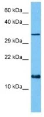 Western Blot: BET1 Antibody [NBP3-10821] - Western blot analysis of BET1 in Human HepG2 Whole Cell lysates. Antibody dilution at 1ug/ml