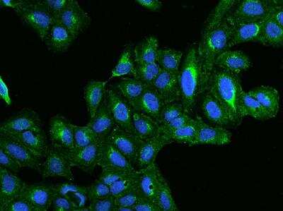 Immunocytochemistry/Immunofluorescence: BET1L Antibody [NBP3-05961] - Staining of BET1L in U2OS cells. Cells were fixed with 4% PFA, permeabilzed with 0.1% Triton X-100 in PBS,blocked with 10% serum, and incubated with rabbit anti-Human BET1L polyclonal antibody (dilution ratio 1:100) at 4? overnight. Then cells were stained with the Alexa Fluor®488-conjugated Goat Anti-rabbit IgG secondary antibody (green) and counterstained with DAPI (blue).Positive staining was localized to Cytoplasm.